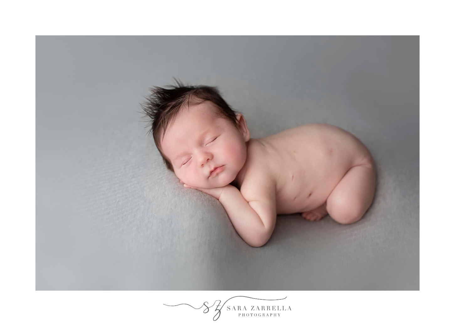 baby with scars from diaphragmatic herniation surgery sleeps during newborn portraits